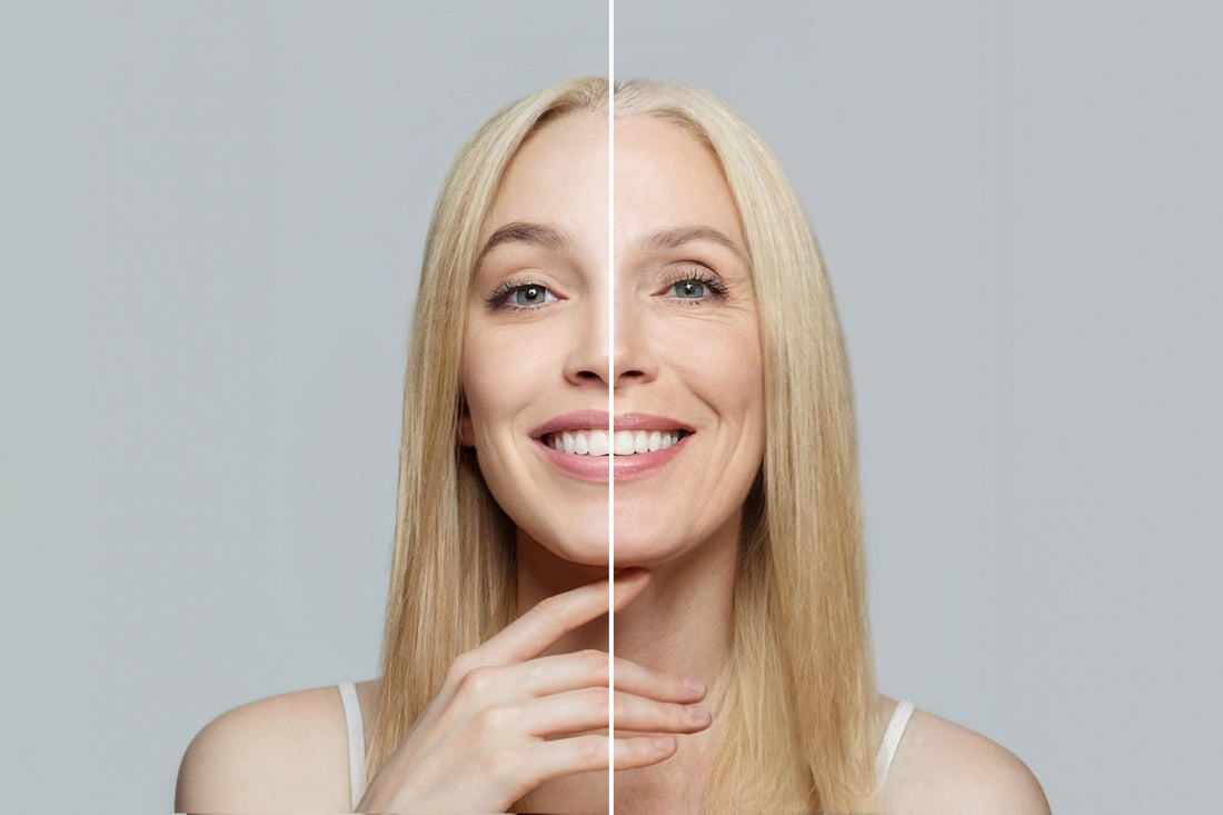 Get Your Glow Back: How Fillers and HALO Laser Rejuvenate Your Face After Rapid Weight Loss