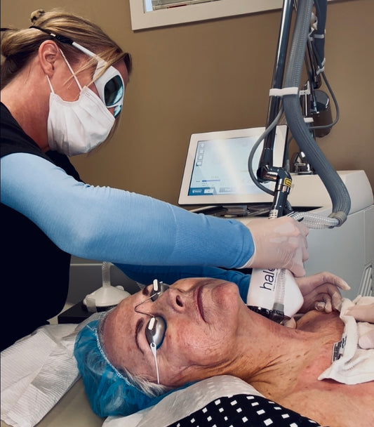 Halo Resurfacing Laser + PRP for Face + Neck