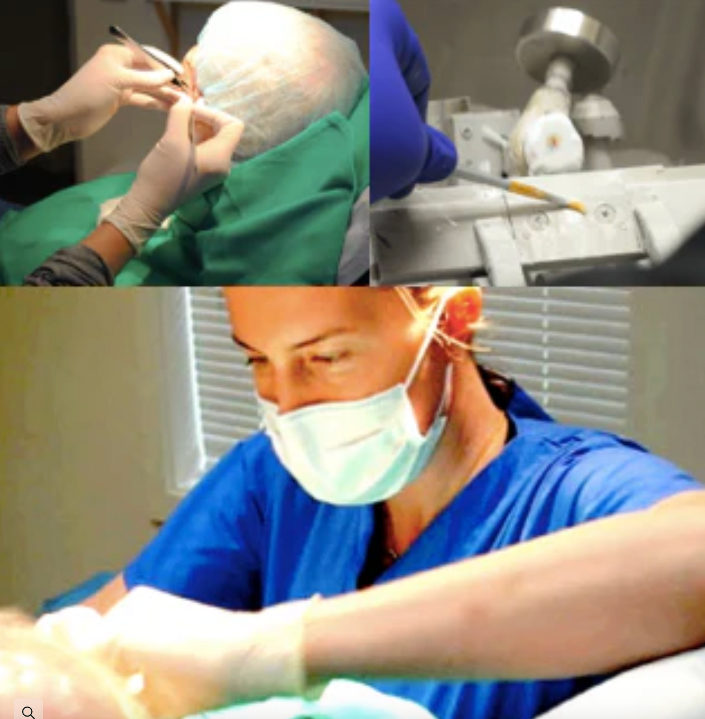 Micrographic Dermatologic Surgery (Mohs) for Skin Cancer