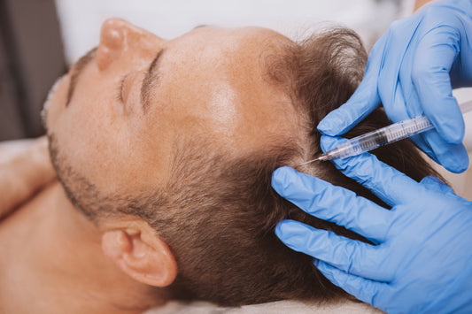 Platelet-Rich Plasma Hair Restoration, scalp