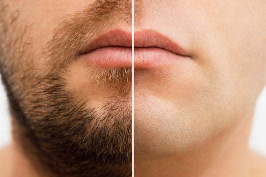 BBL Hair Removal - Lower Face + Neck